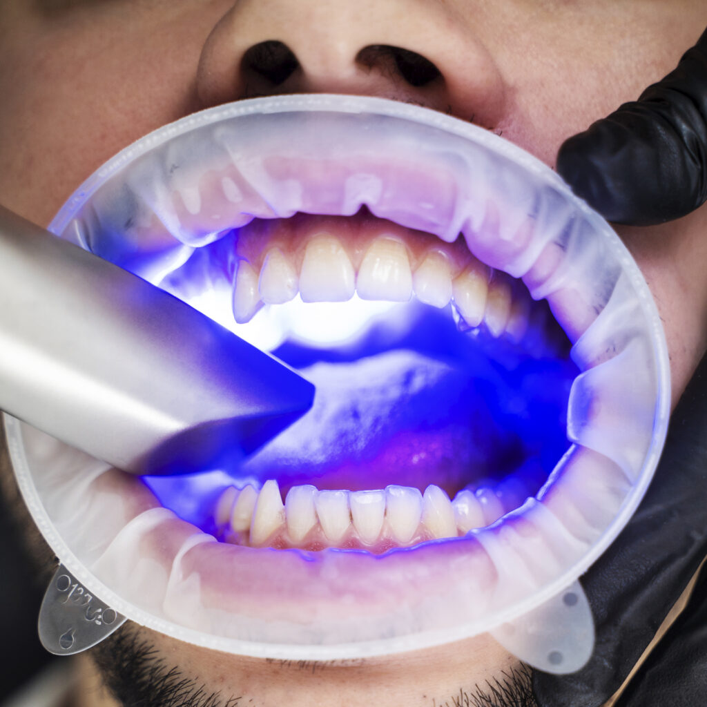 Clínica Dental Alta Estética - Jinotega