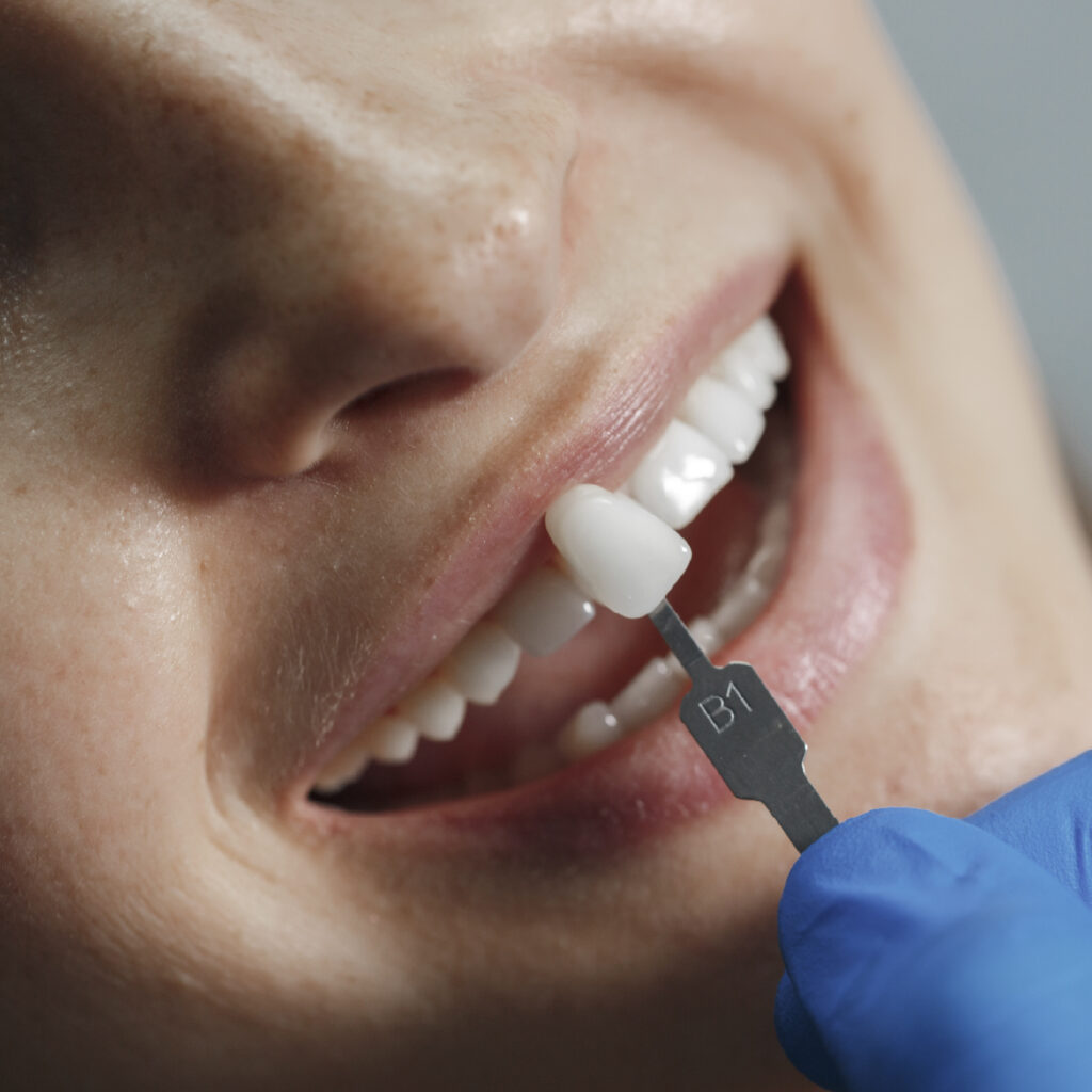 Clínica Dental Alta Estética - Jinotega