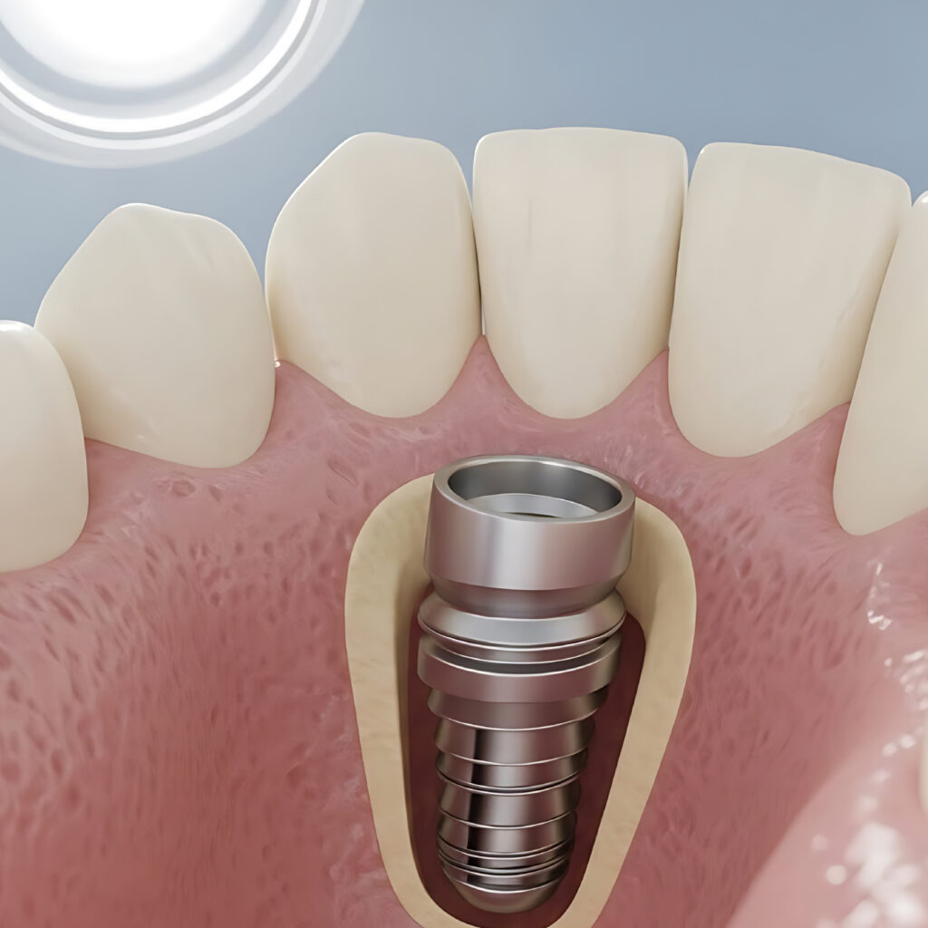 Clínica Dental Alta Estética - Jinotega